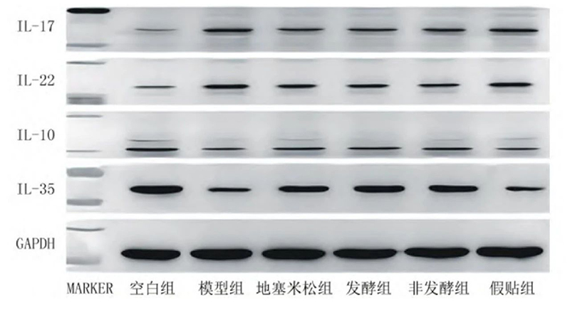 空白组和支气管哮喘各组大鼠肺组织中IL－17、IL－22、IL－10、IL－35蛋白表达电泳图